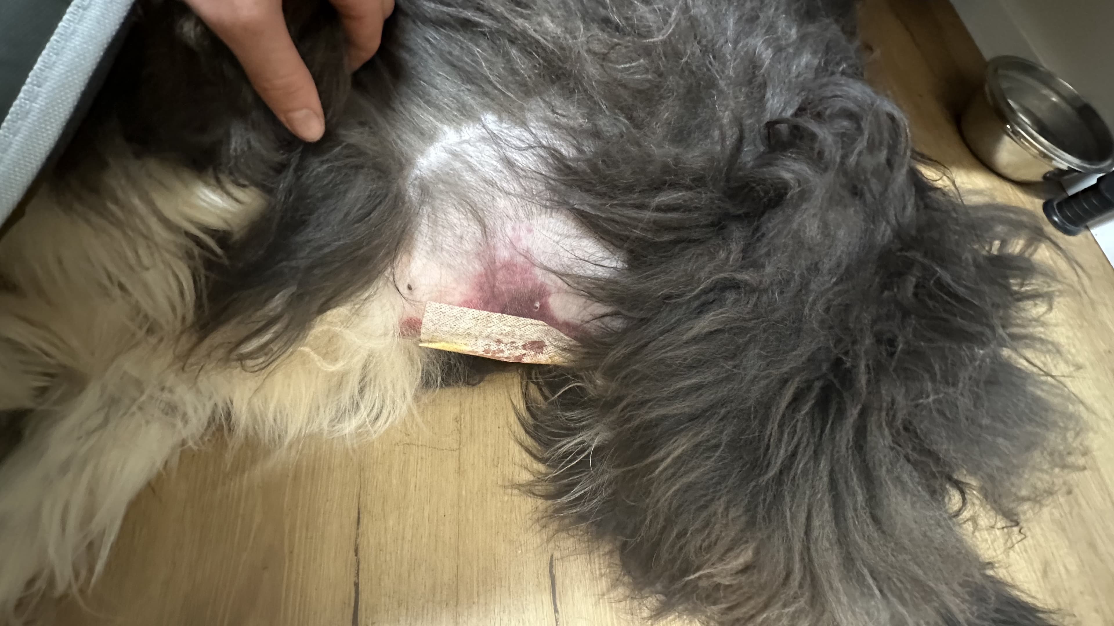 Arons Narbe nach der Milztumor-Operation